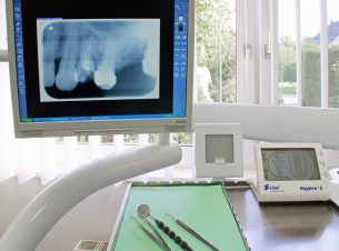Zahnarztpraxis Stefan Hoffmann - Wurzelkanalbestimmung